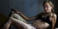 Foto: AP Photo/Brent Stirton / POLFOTO