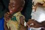 Der er sket et fald i antallet af børn, der bliver vaccineret mod mæslinger. Det har medført, at antallet af smittede er steget med næsten 300 procent siden 2018. Her ses et barn, der vaccineres mod mæslinger i Uganda, hvor myndighederne kæmper for at øge andelen af vaccinerede børn.