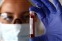 På Island har man testet knap 10.000 personer for smitte med coronavirus. (Arkivfoto)
