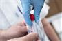Gigtmedicin kan måske være med til at forhindre den lungebetændelse, der kan opstå som følge af infektion med coronavirus. (Arkivfoto)