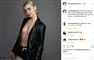 Emmelie de Forest er helt bar i en blazer
