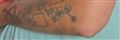 billede af Matias' tatoveringer