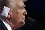 Trump med forbinding