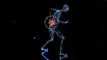 et x-ray af en person
