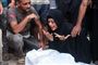 krigsramte i Gaza