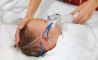 baby med iltmaske