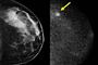 Flere scanninger skal redde danske kvinders liv.
 Foto: AP/The Mayo Clinic / POLFOTO