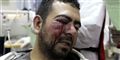 Foto: JOSEPH EID  / Scanpix