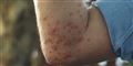 Foto: Biosecurity Queensland/Free